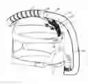 Fig. 01 - Breathing assistance apparatus