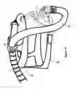 Fig. 10 - Breathing assistance apparatus