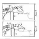 Fig. 18 - Breathing assistance apparatus