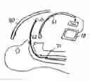 Fig. 01 - Apparatus for introducing an airway tube into the trachea having visualization capability and methods of use