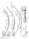 Fig. 04 - Apparatus for introducing an airway tube into the trachea having visualization capability and methods of use