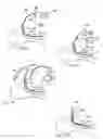 Fig. 05 - Apparatus for introducing an airway tube into the trachea having visualization capability and methods of use