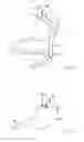 Fig. 02 - Methods and apparatus for revision of obesity procedures
