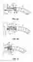 Fig. 04 - Methods and apparatus for revision of obesity procedures