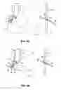 Fig. 12 - Methods and apparatus for revision of obesity procedures