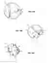 Fig. 20 - Methods and apparatus for revision of obesity procedures