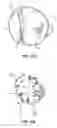 Fig. 22 - Methods and apparatus for revision of obesity procedures
