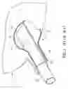 Fig. 02 - Support for valve of inflatable bag