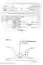 Fig. 08 - Method and device in a paper or board machine line for straining paper