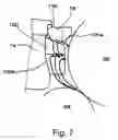 Fig. 08 - Transmission