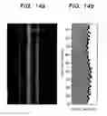 Fig. 15 - Multi-capillary array electrophoresis device
