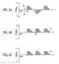 Fig. 06 - Regeneration of electrolytic ion exchange cells