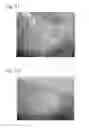 Fig. 07 - MICROFLUIDIC SYSTEMS INCLUDING POROUS POLYMER ELECTRODES