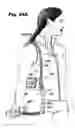 Fig. 53 - Multi-Pack Tote Apparatus
