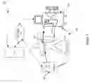 Fig. 03 - Cardiac rhythm management device and sensor-suite for the optimal control of ultrafiltration and renal replacement therapies