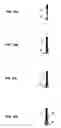 Fig. 09 - Device and method for separating magnetic or magnetizable particles from a liquid