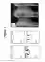 Fig. 02 - Notch-Free Etching of High Aspect SOI Structures Using A Time Division Multiplex Process and RF Bias Modulation