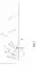 Fig. 02 - Retractable trash container tether