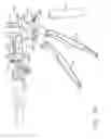 Fig. 30 - Motor-driven surgical cutting and fastening instrument with loading force feedback