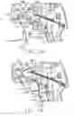 Fig. 35 - Motor-driven surgical cutting and fastening instrument with loading force feedback