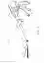 Fig. 03 - Surgical cutting and fastening instrument with closure trigger locking mechanism
