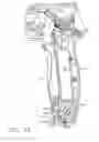 Fig. 17 - Surgical cutting and fastening instrument with closure trigger locking mechanism