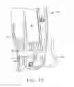 Fig. 17 - Surgical instrument having recording capabilities