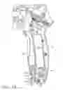 Fig. 18 - Surgical instrument having recording capabilities