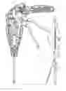 Fig. 48 - Surgical instrument having recording capabilities