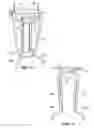 Fig. 08 - Lifting anchor support