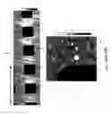 Fig. 03 - Variable density scanning