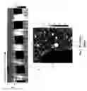 Fig. 05 - Variable density scanning