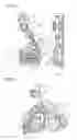 Fig. 02 - Poured molten metal quantity control device
