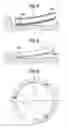 Fig. 03 - Compression coil spring device having a discrete support
