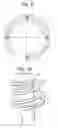 Fig. 05 - Compression coil spring device having a discrete support