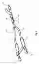 Fig. 03 - Child safety seat, shell and harness