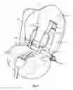 Fig. 04 - Child safety seat, shell and harness