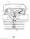 Fig. 06 - Child safety seat, shell and harness