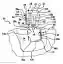 Fig. 01 - Removable electronic tablet for vehicle instrument panel