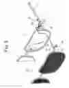 Fig. 06 - Pivotally openable type spectacles and sunshade-clip assembly