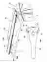 Fig. 05 - Device for the protection of the bodywork of a vehicle