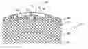 Fig. 01 - Speaker grille attachment system