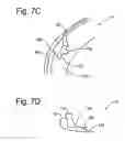 Fig. 09 - Speaker grille attachment system