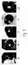 Fig. 03 - Method and apparatus for setting a detection threshold in processing medical images