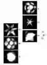 Fig. 06 - Method and apparatus for setting a detection threshold in processing medical images