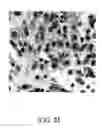 Fig. 18 - Diagnostic scanning microscope for information-enriched qualitative histopathology