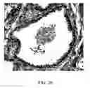 Fig. 19 - Diagnostic scanning microscope for information-enriched qualitative histopathology