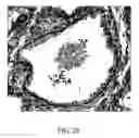 Fig. 22 - Diagnostic scanning microscope for information-enriched qualitative histopathology
