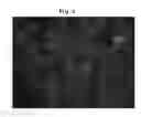 Fig. 04 - Composition Comprising Separated or Proliferated Cells from Umbilical Cord Blood for Treating Developmental and/or Chronic Lung Disease