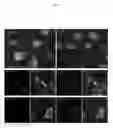 Fig. 06 - Side population cells in cardiac repair